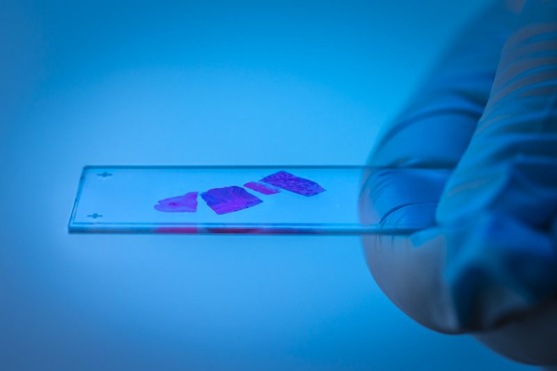 Slide with Biopsy © Leo Hillier