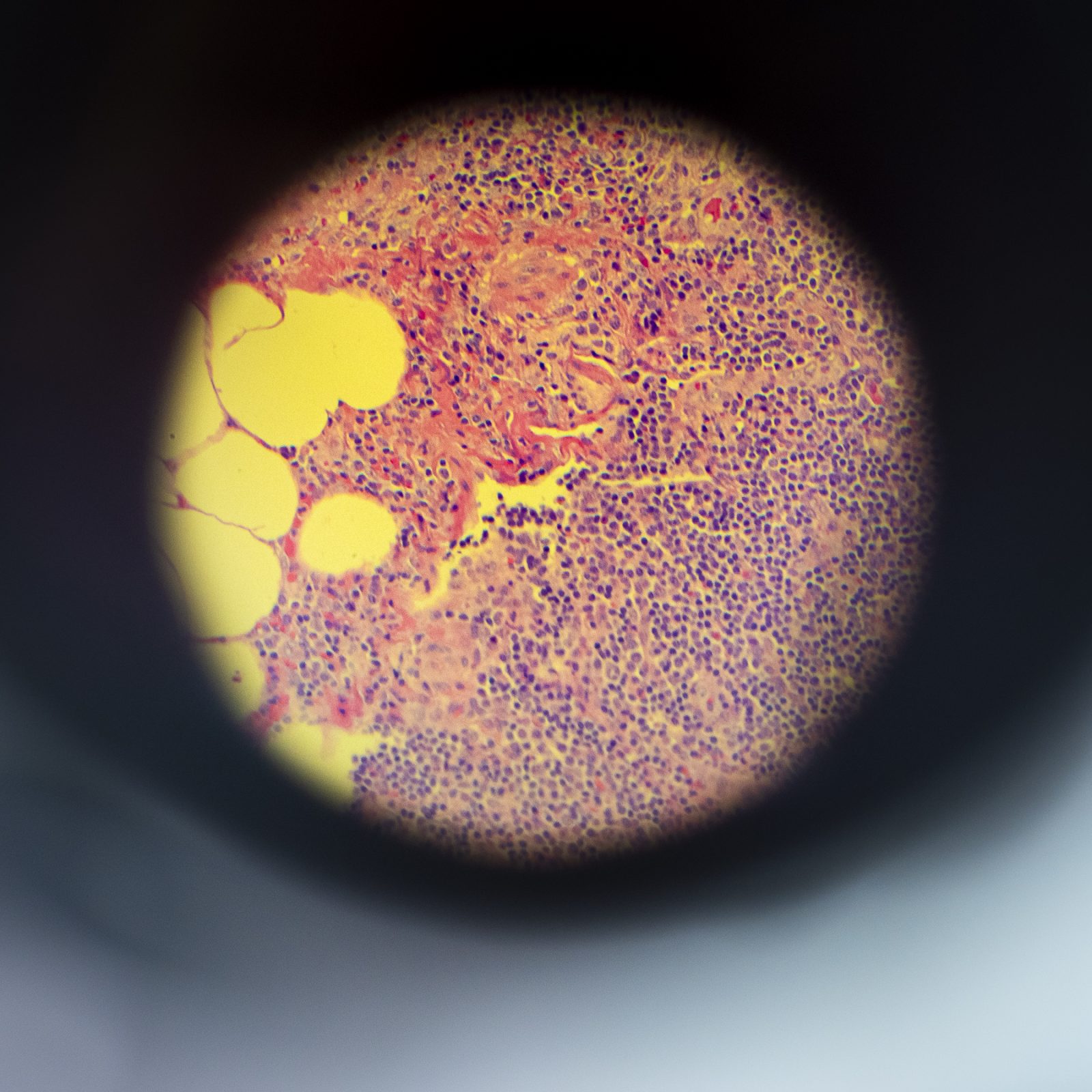 Looking into a microscope © Leo Hillier